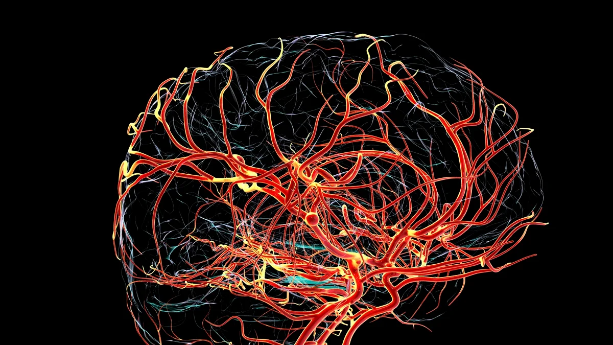 Alterações do Alzheimer podem surgir antes de falhas na memória, diz estudo