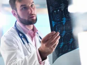 Spray nasal feito de placenta humana reduz efeitos de Alzheimer em animais
