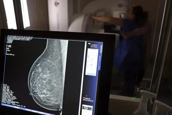 Outubro Rosa: tempo de espera por mamografia cai para 10 dias em BH