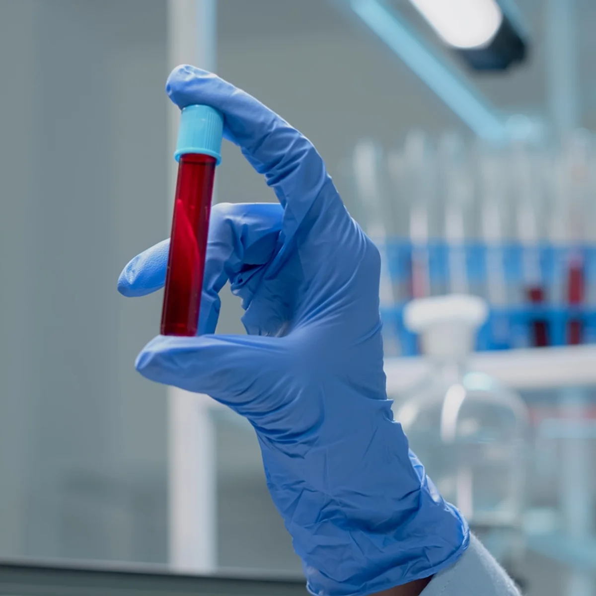 Novo exame de sangue que detecta mais de 50 tipos de câncer chega ao Brasil