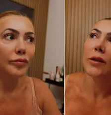 Fabiana Teixeira relatou ter sido diagnosticada com um cisto no cérebro Foto: Reprodução/Instagram